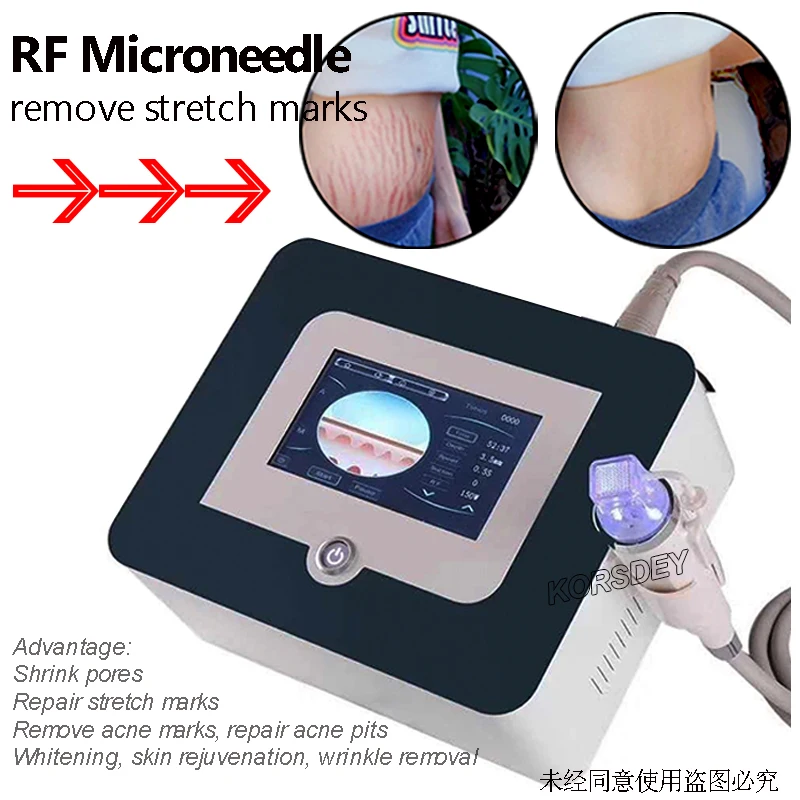 

most advanced fractional rf microneedle machine/ rf microneedle radio frequency most popular face lifting rf micro needle