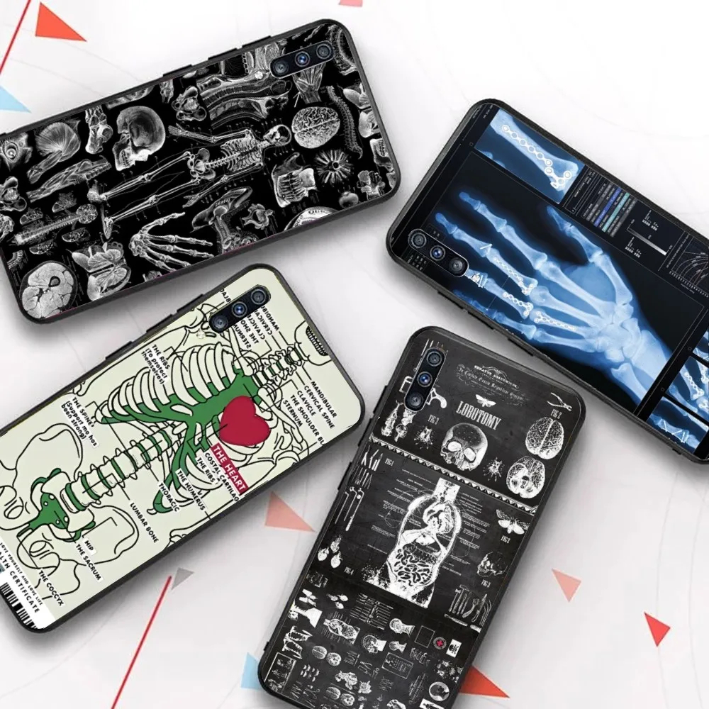 

Human Organs Skeleton Skull Phone Case For Samsung A 10 11 12 13 20 21 22 30 31 32 40 51 52 53 70 71 72 73 91 13 Shell