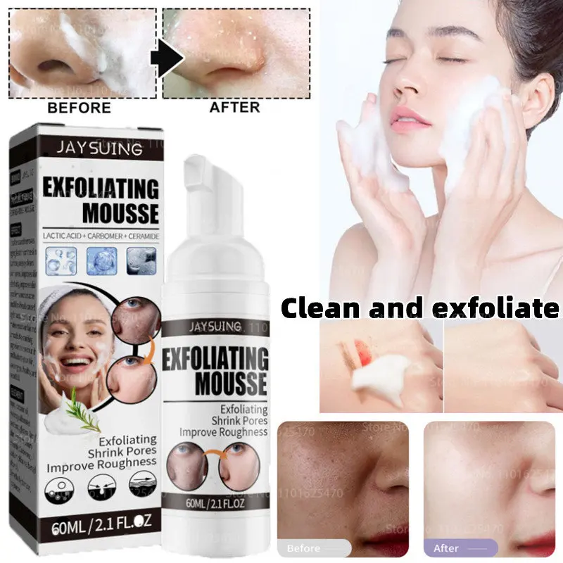 

Cleansing Mousse Facial Cleanser Remove Blackheads, Deep Cleansing Brightening and Whitening Facial Exfoliating Facial Cleanser