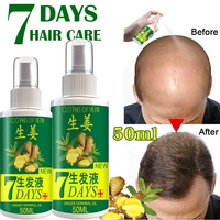 10203050ml ginger hair loss treatment fast hair regrowth essential oil 7 days anti loss strong the root of hair serum