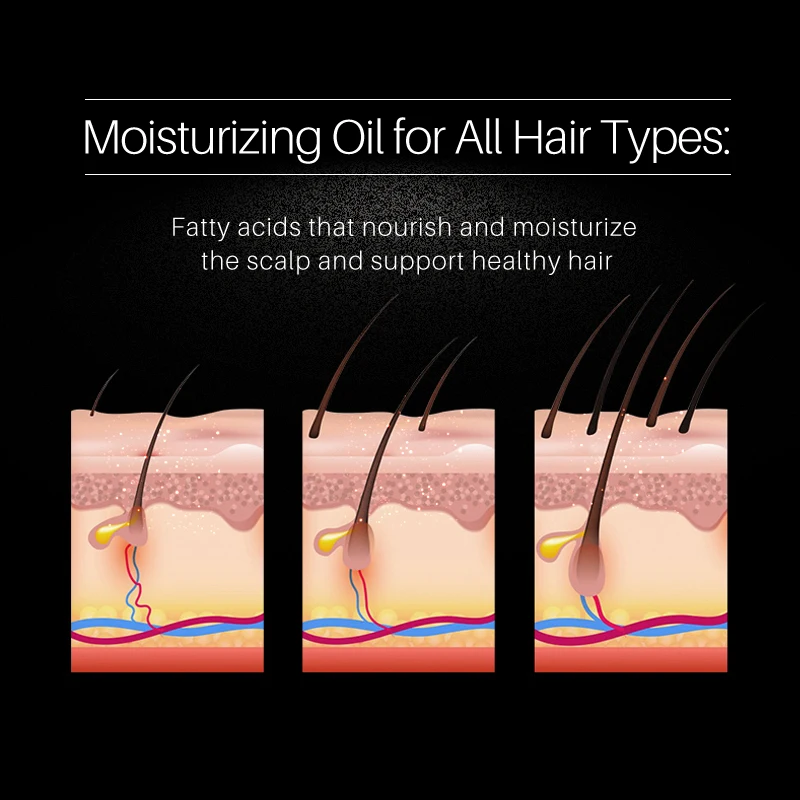 Масло для роста семян черного риса эфирное масло защиты от выпадения волос сухой