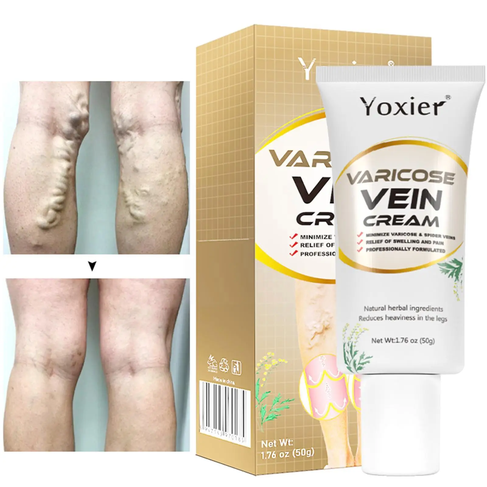 

Treatment Legs Varicose Vein Cream Soothing Repair Cream Circulation Blood Pain Cream Phlebitis Spider Relief Vein Promotes J4c2
