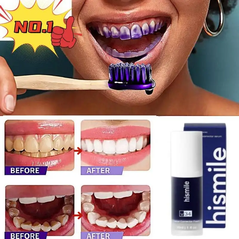 

V34 Instant Teeth Whitener Teeth Whitening Instrument Teeth Brightener Purple Toothpaste Whitening Teeth Repair Reduce Yellowing