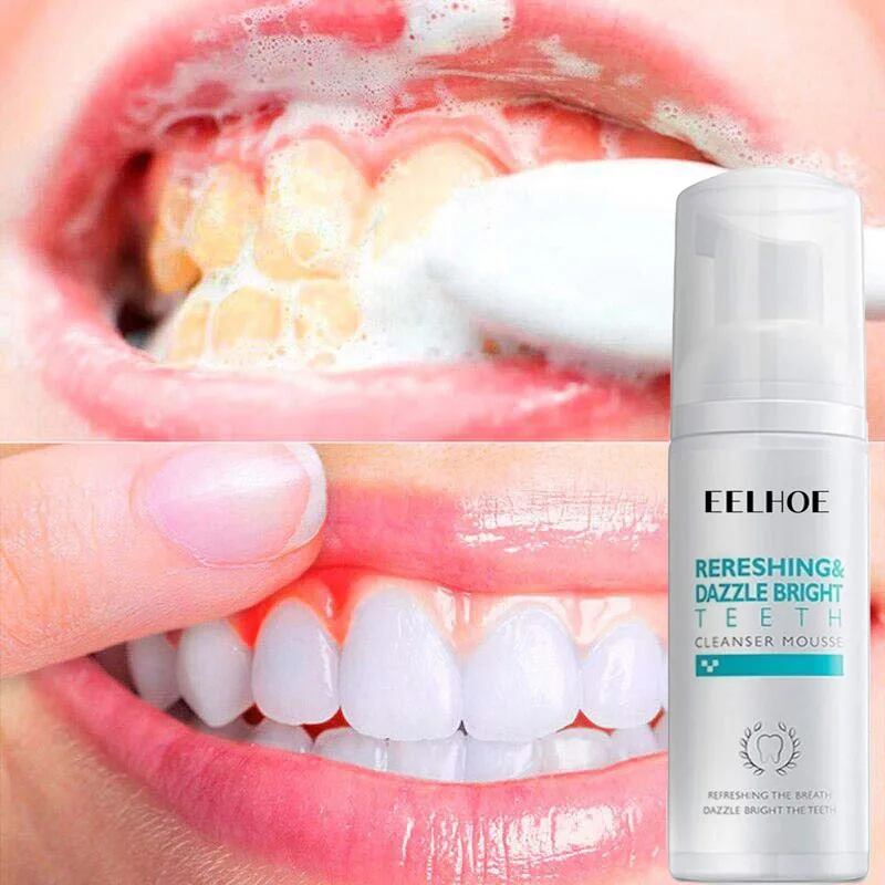 

Teeth Whitening Mousse Dental Bleaching Deep Cleaning Remove Plaque Stains Dentistry Tool Fresh Breath Oral Hygiene Product 60ml