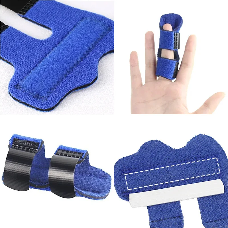 Шина для фиксации пальцев облегчение боли триггер выпрямление брекеты