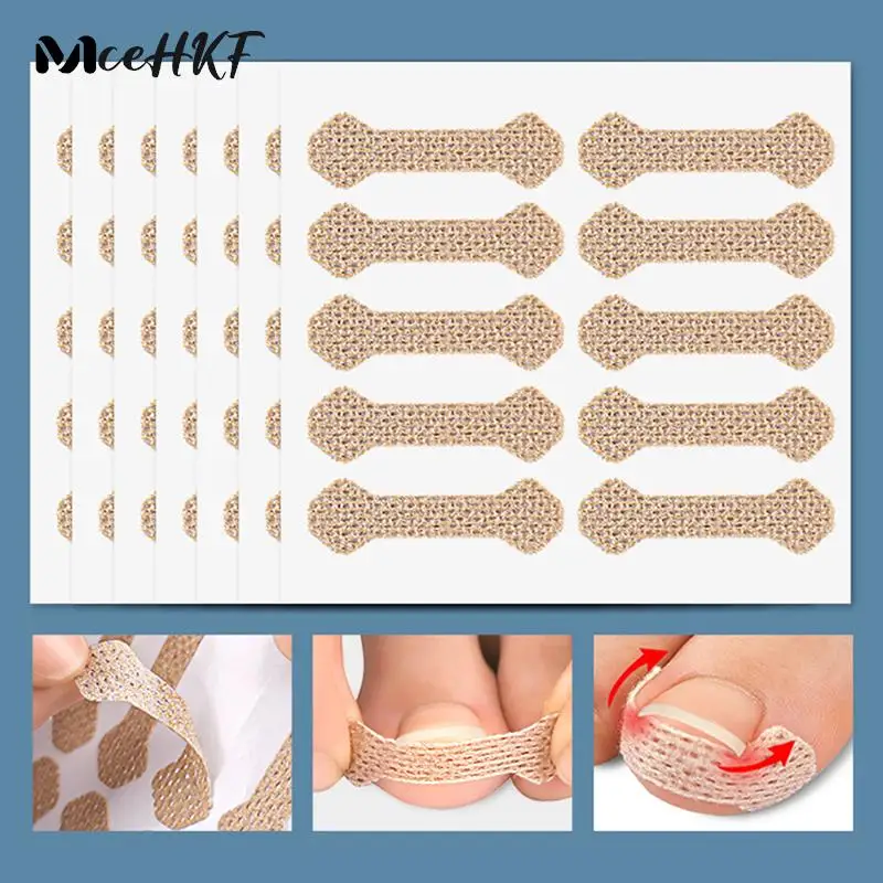 

4/10Sheets Feet Care Toenail Stickers Pedicure Ingrown Nail Tool For Nail Corrector Paronychia Treatment Fixer Recover Bunion