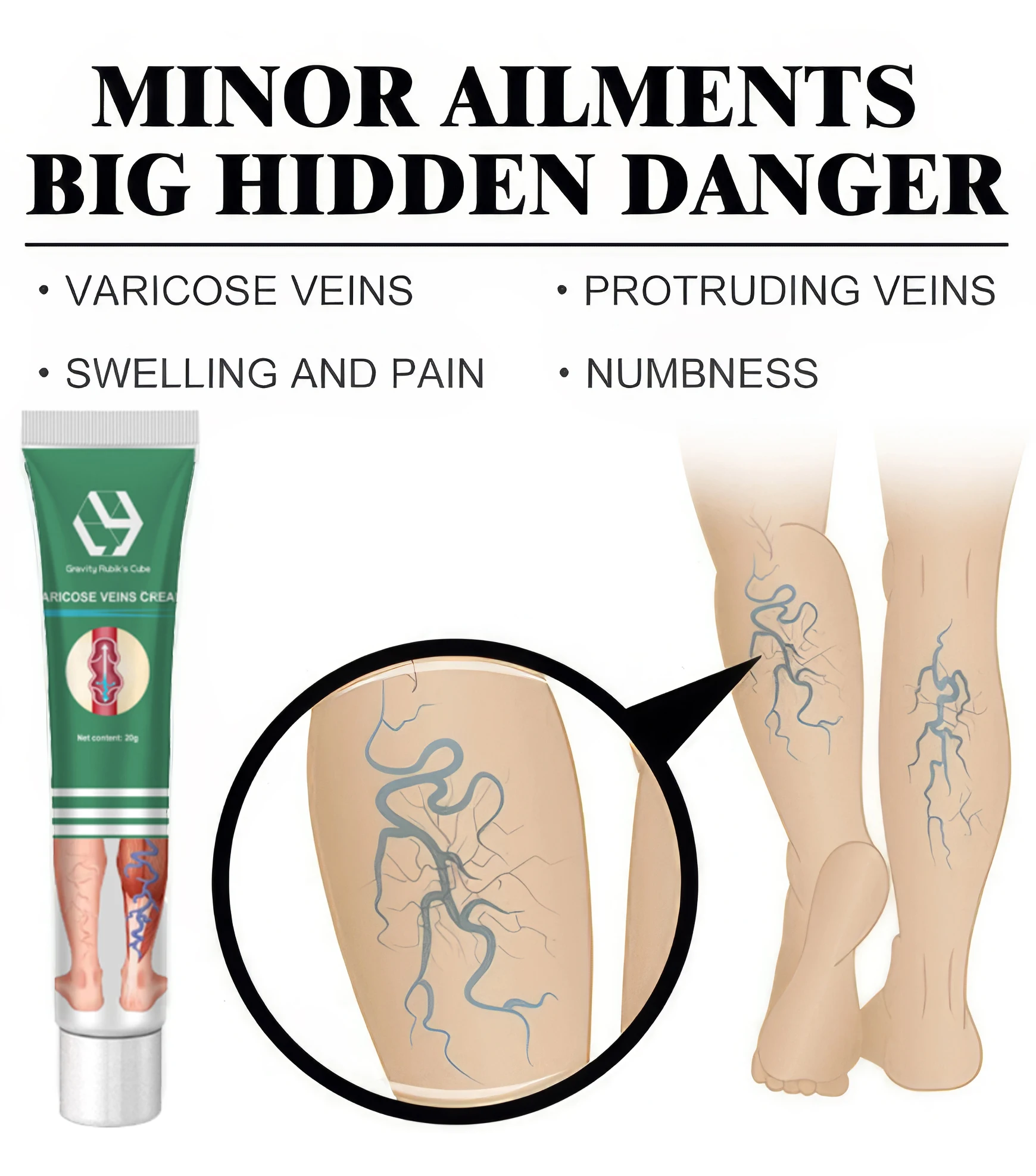 Крем-лазер Varicosse