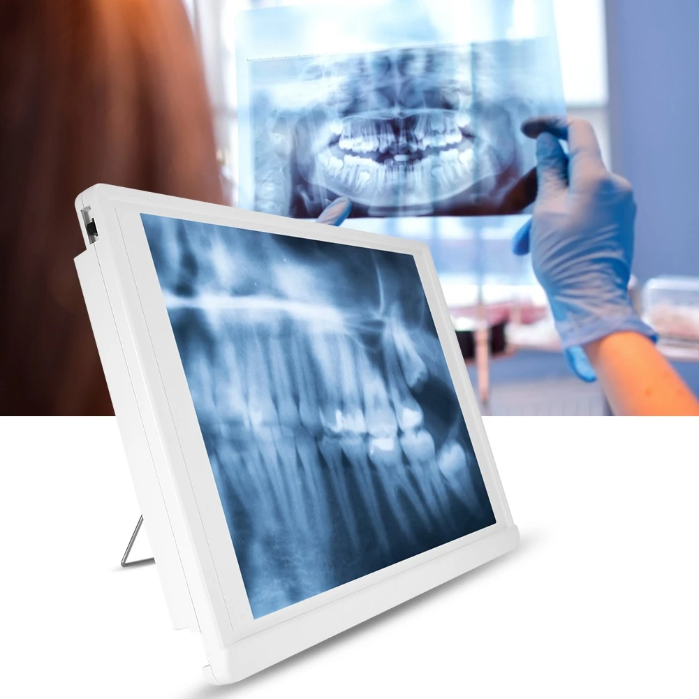 A4 Dental Film Viewer X-Ray Illuminator Dental Lab Tools Light Box Dentist Oral hygiene panorama Viewbox Xray Panel Screen