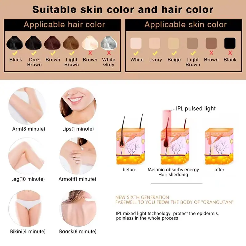 Рисунок 6 - Лазерный эпилятор для удаления волос IPL с охлаждением