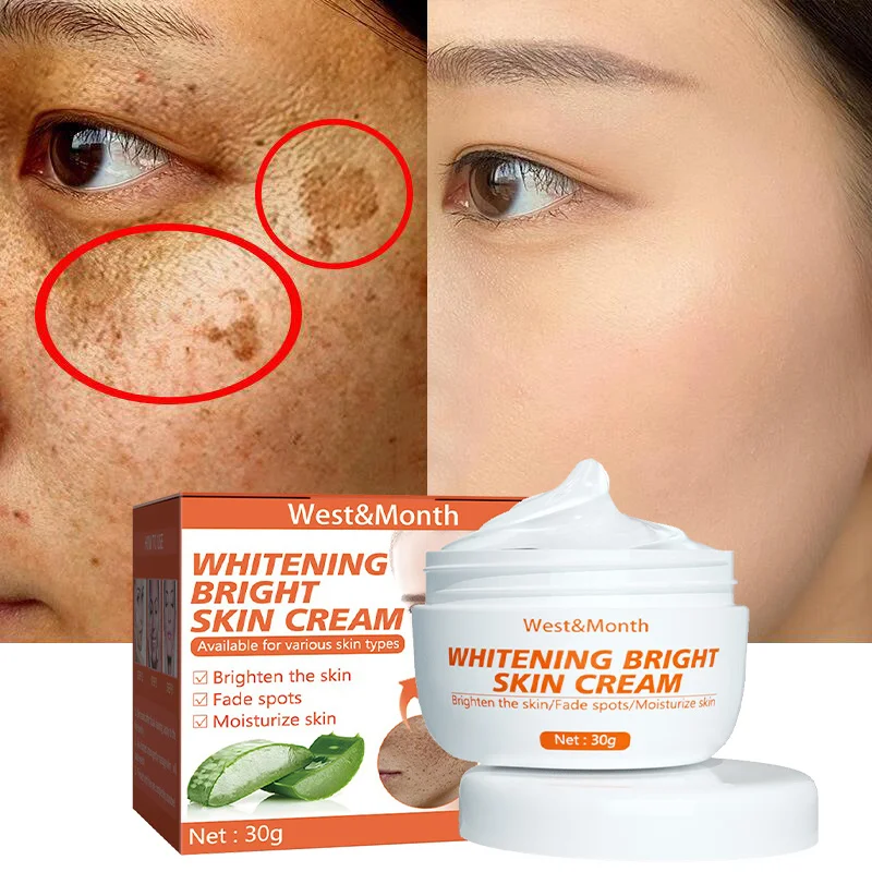 Whitening Freckles Cream Remove Melasma Dark Spot Lightening Melanin Brightening Moisturize Anti-aging Fade Fine Lines Face Care