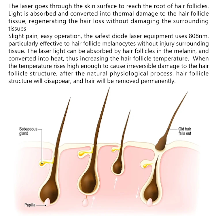 300 нм лазерный диод 400 Вт 500 600 700 800 900 1000 Выходная мощность в золотой оловянной