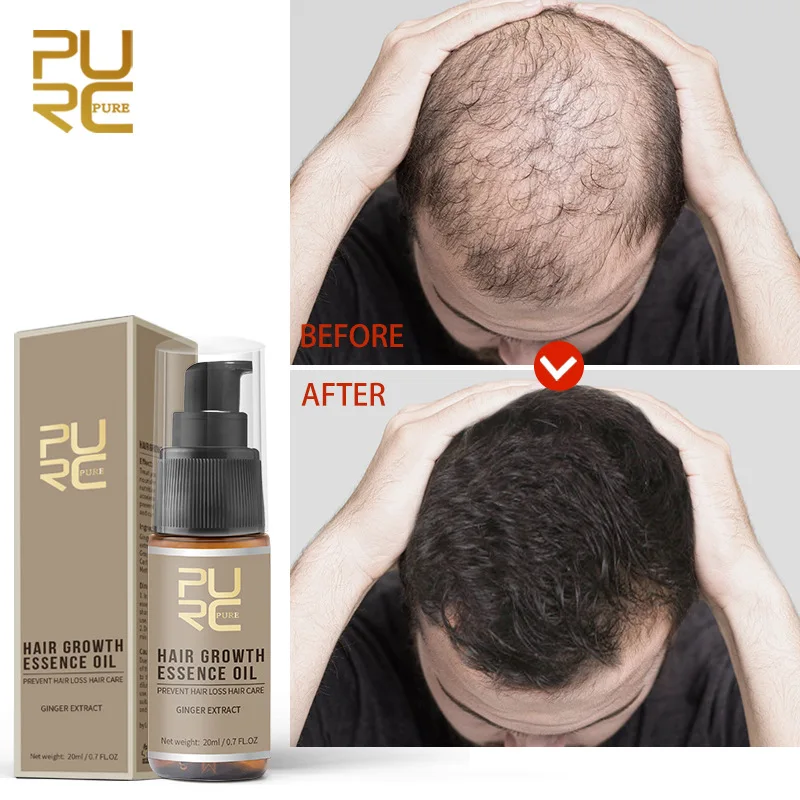 

PURC Ginger Essential Hair Growth Oil Liquid Anti Hair Loss Baldness Remedy Boost Grow Thicker Hair Care Scalp Treatment 20ml