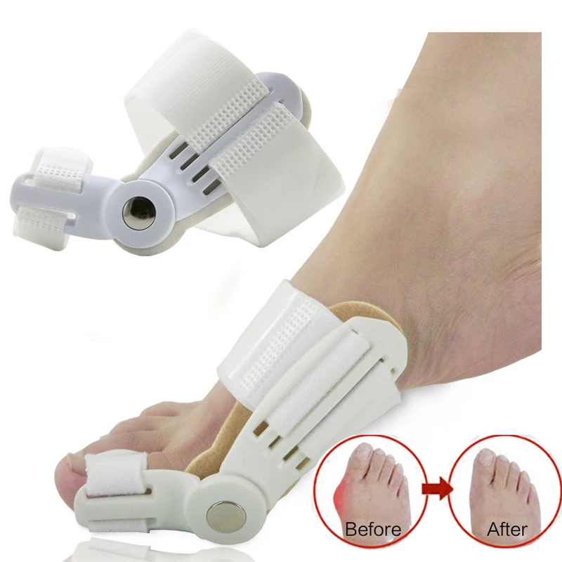 

Bunion Splint Big Toe Straightener Corrector Foot Pain Relief Hallux Valgus Correction Orthopedic Supplies Pedicure Foot Care