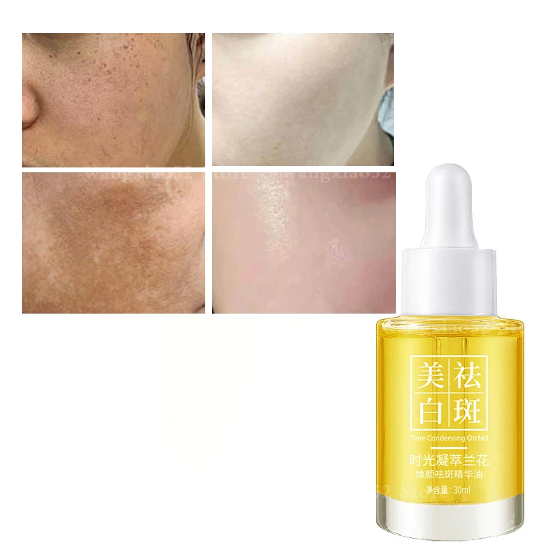 

Hot selling whitening freckle oil moisturizing moisturizing brightening face lightening spots facial essence oil skin care 30ml