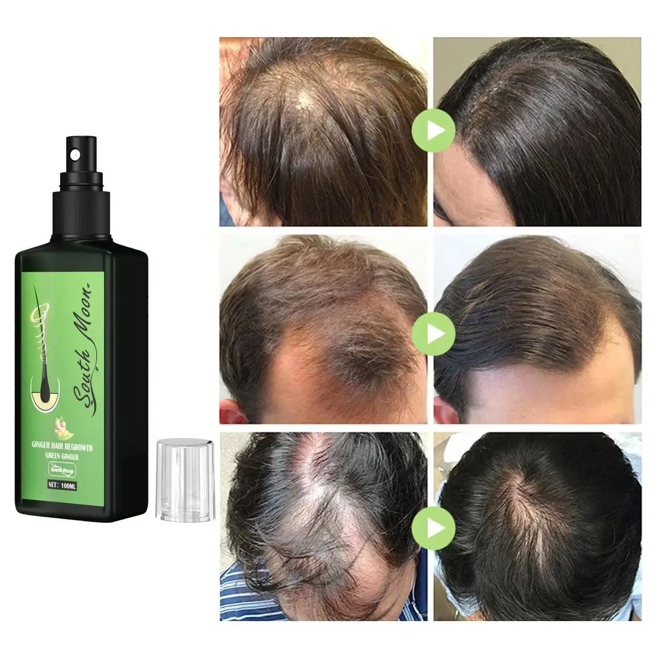 Масло для ухода за волосами 100 мл имбирное масло роста волос предотвращение - Фото №1