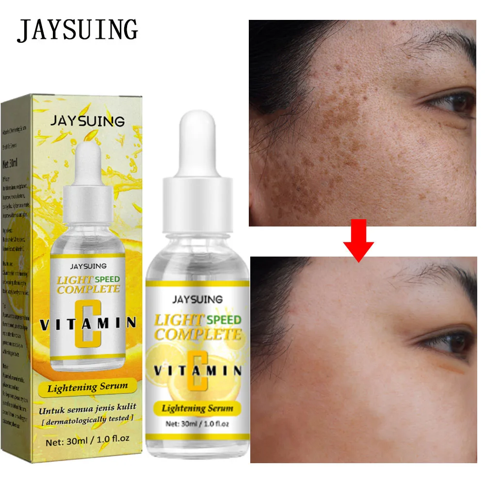 

Vitamin C Whitening Freckle Serum Remove Dark Spots Fade Melanin Pigmentation Anti-aging Moisturizing Brighten Beauty Skin Care