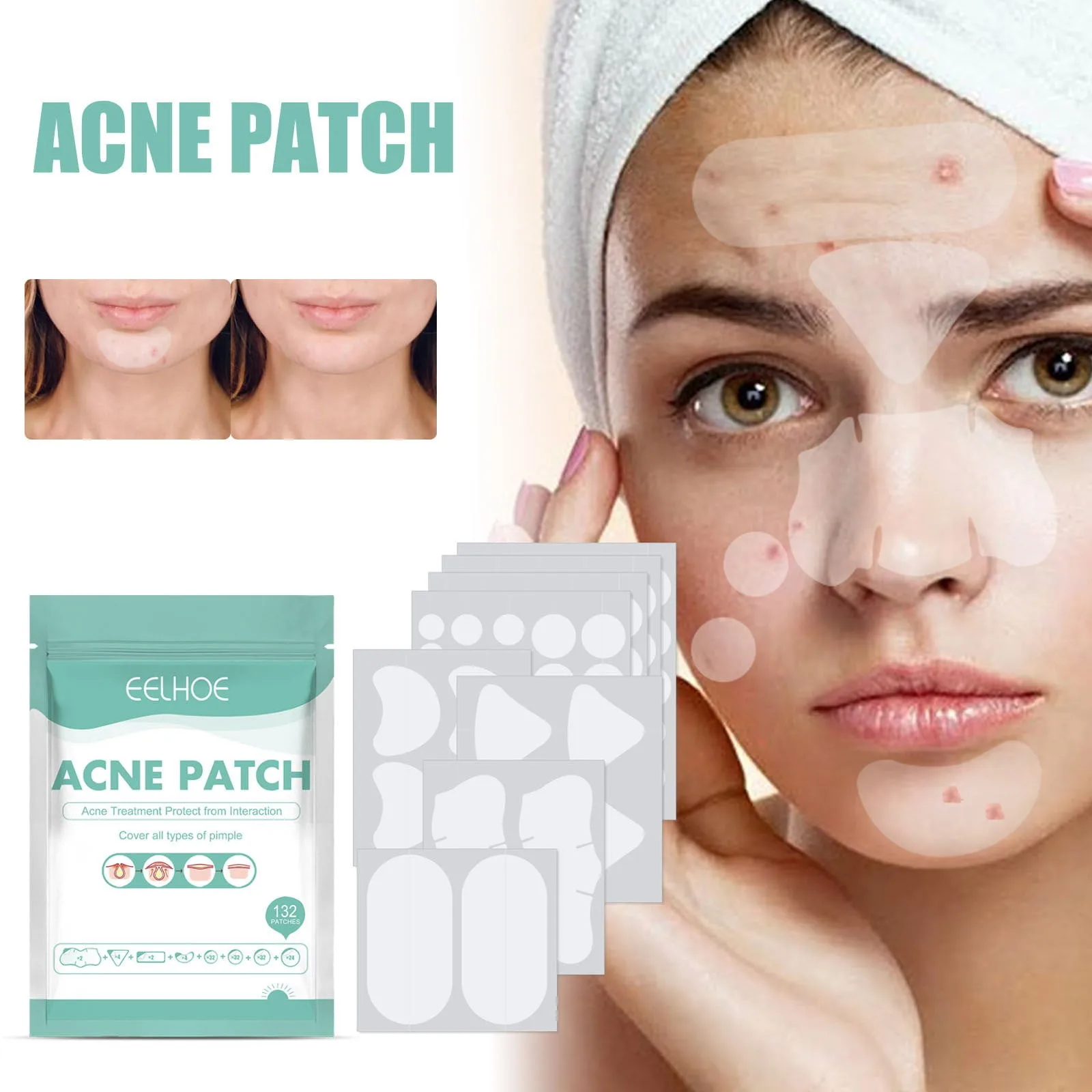 

Acne Pimple Patch Sticker 102 For Large Zit Breakouts Acne Patches For Face Chin Or Body Hydrocolloid Bandages Acne With Tea