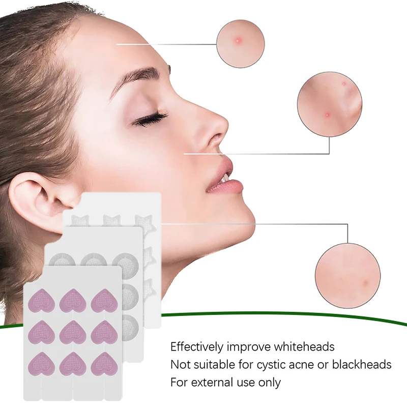 Наклейки Микроиглы против прыщей Удаление Успокаивающая кожа Пластыри для лица