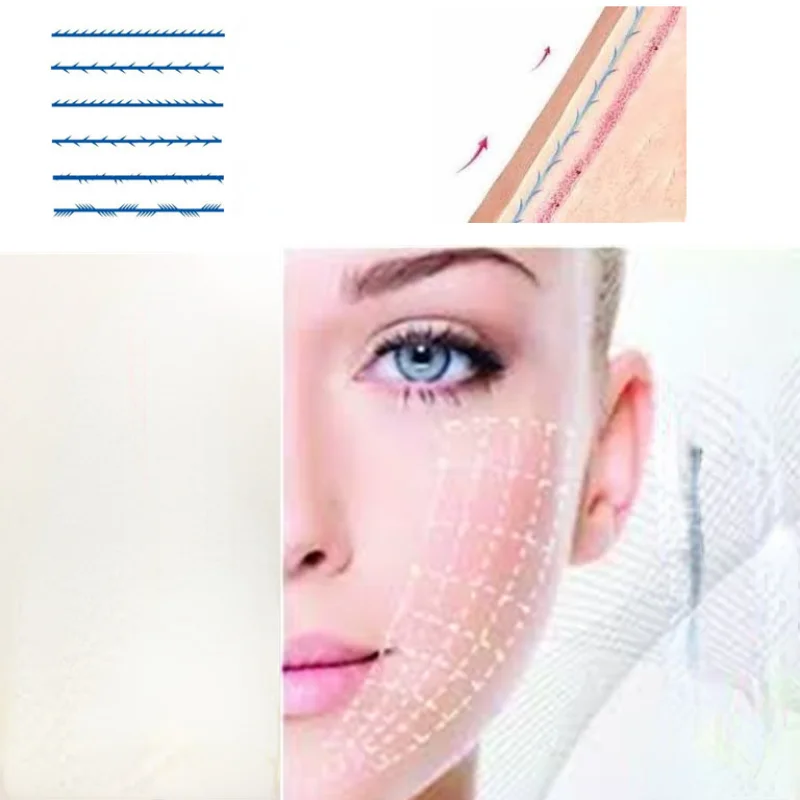 

Pcl-19G38mm-w Fish Bone Uverla Protein Thread PDO PLA-CL PCL Nose Thread UVERLA Imprinting Fishbone Thread Beauty Products