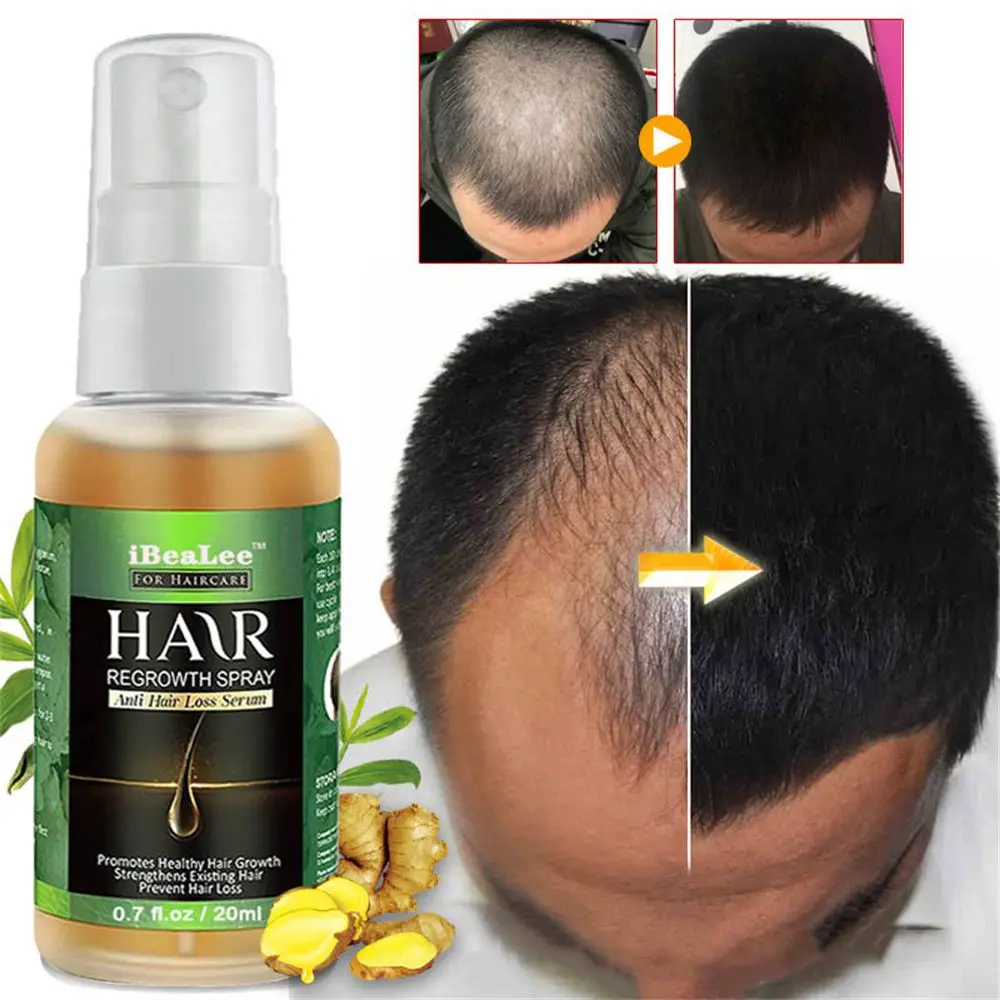 

20ML Hair Care Hair Growth Essential Oils Essence Original Authentic Hair Loss Liquid Health Care Beauty Dense Hair Growth Serum