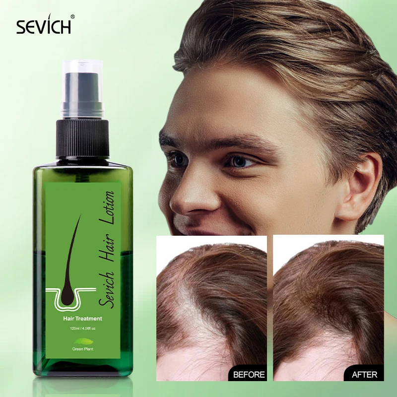 Anti Hair Loss Treatment Green Plant Hair Scalp Treatments Product Hair Growth Lotion