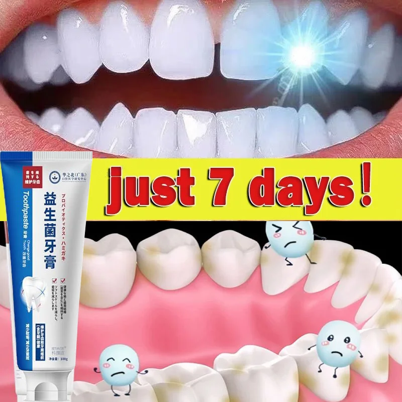 

100g Quick Repair of Cavities Caries Toothpaste Whitening Yellowing Dark Teeth Removal of Plaque Stains Oral Clean Decay Essence