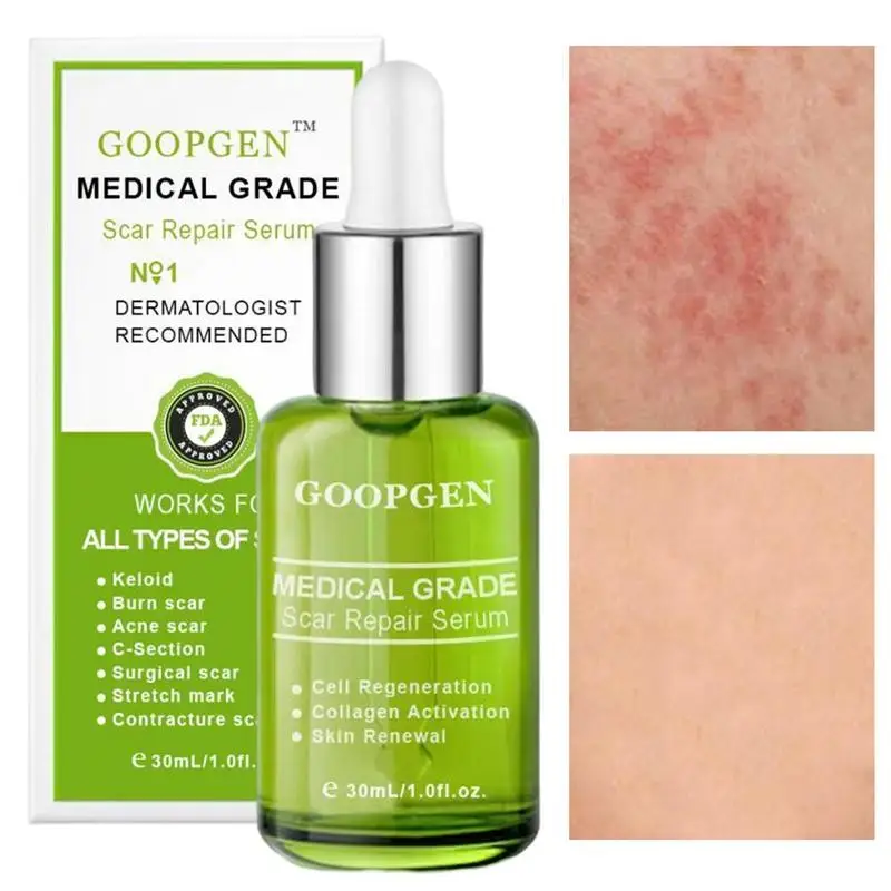 

Сыворотки для восстановления шрамов, быстрое удаление шрамов на коже, лечение шрамов, растяжек, ожогов, уход за лицом