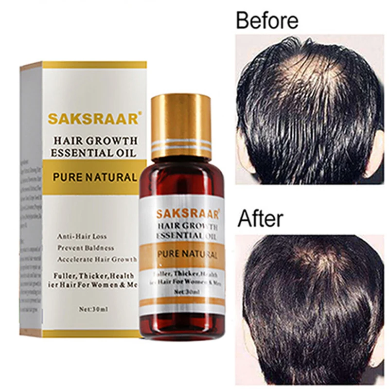 

30ML Hair Growth Essential Oils Hair Care Essence Original Authentic Hair Loss Liquid Health Care Beauty Dense Hair Growth Seru