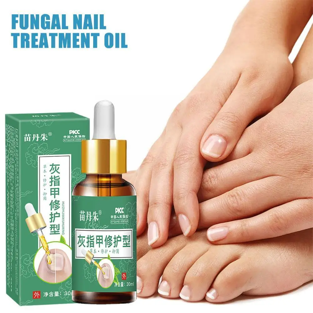 

Gray Nail Care Liquid Foot Repair Essence Toenail Fungus Gel Nail Cream Fungal Removal Removal Anti-infection Z5C6