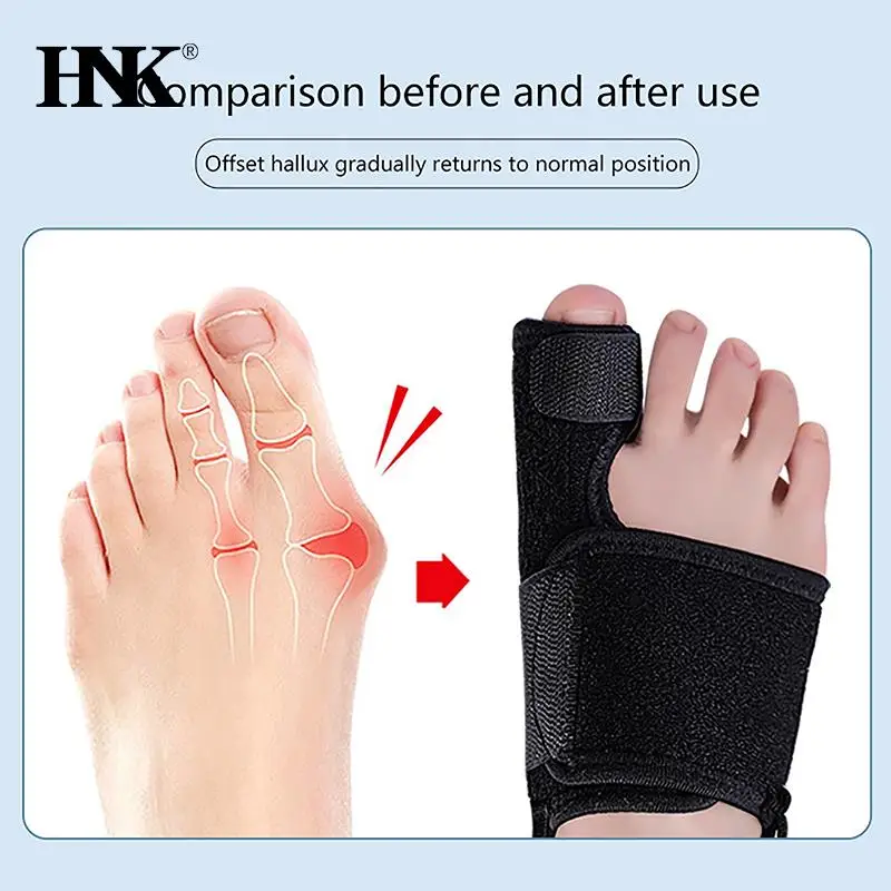 

1PCS Toe Corrector Orthotics Bone Thumb Adjuster Hammer Protector Foot Care Tools Soft Pedicure Sock Bunion Straightener