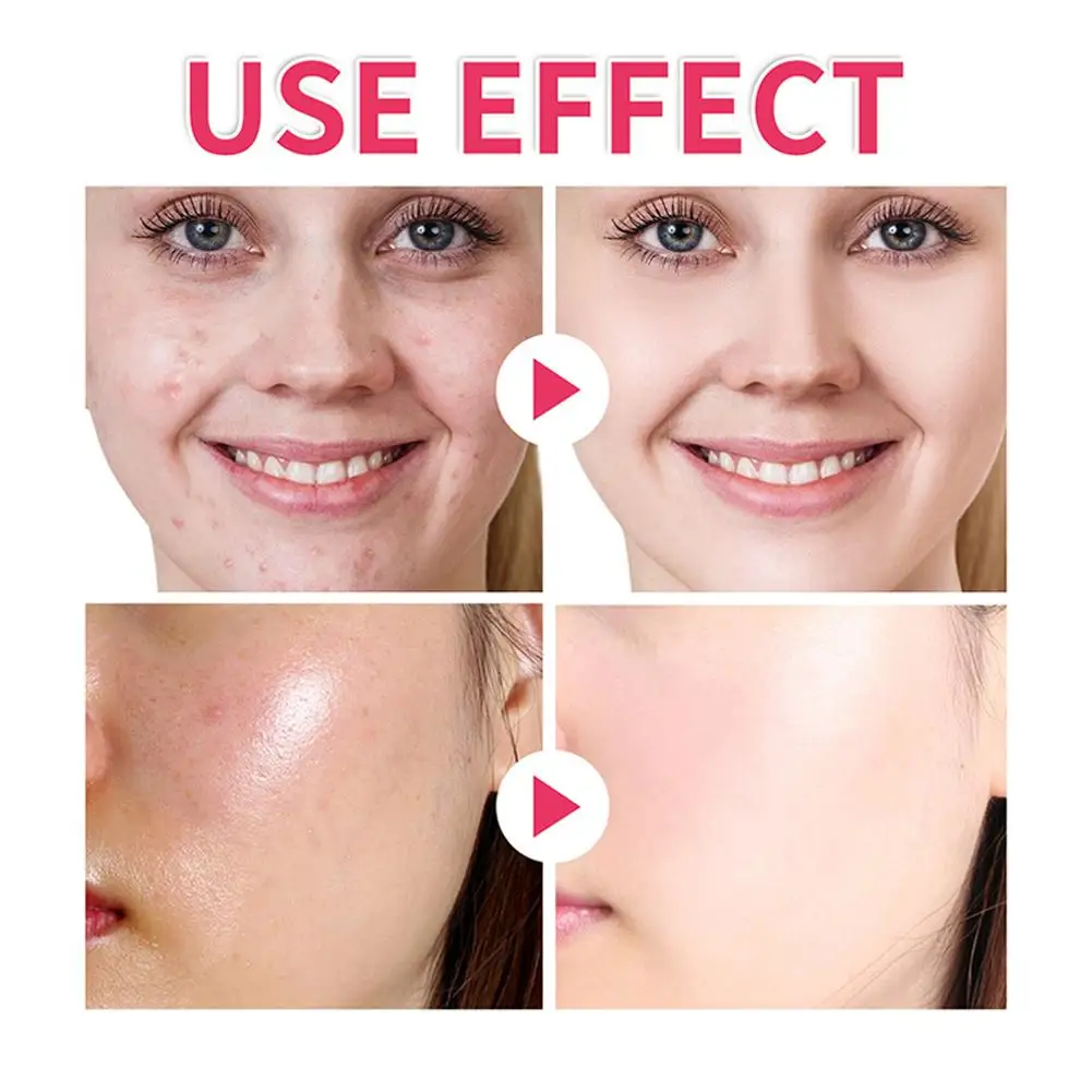 40 подушечек очищающие подушечки с куркумой и койевой кислотой отшелушивающие