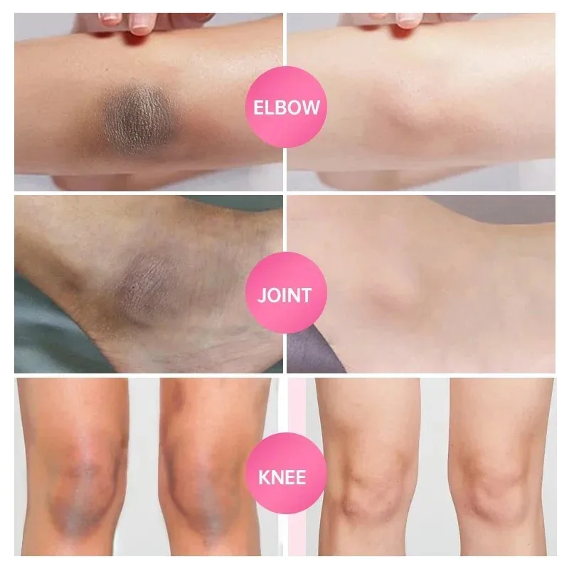 Крем-отбеливатель для улучшения зоны бикини лосьон женщин увлажняющий крем кожи