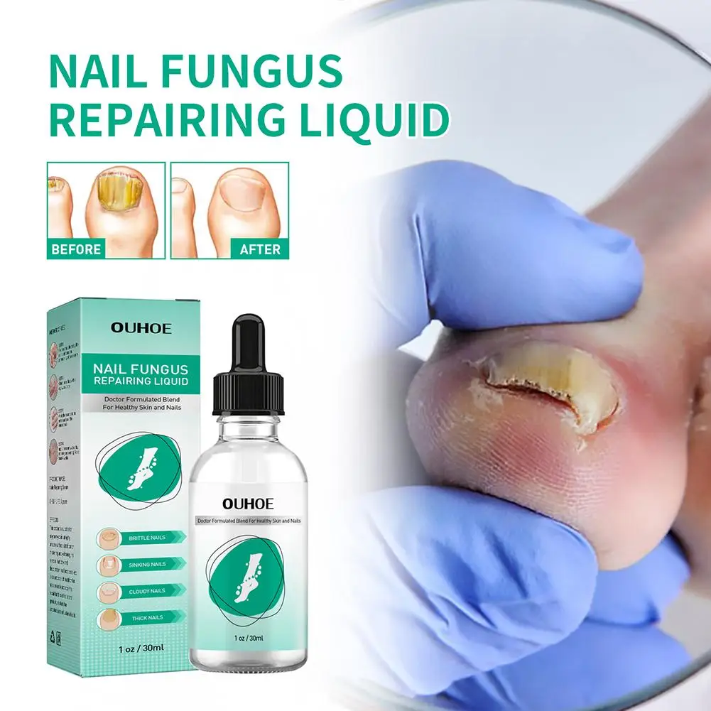 

Nail Fungus Treatment Essence Serum Care Foot Care Removal Repair Gel Anti-infective Healthy Toenail Growth Toe Nail Care 30ml