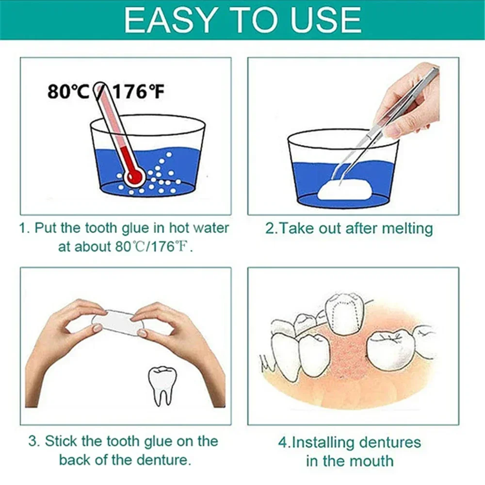 Стоматологические ультратонкие виниры для отбеливания фарфоровые материалы из