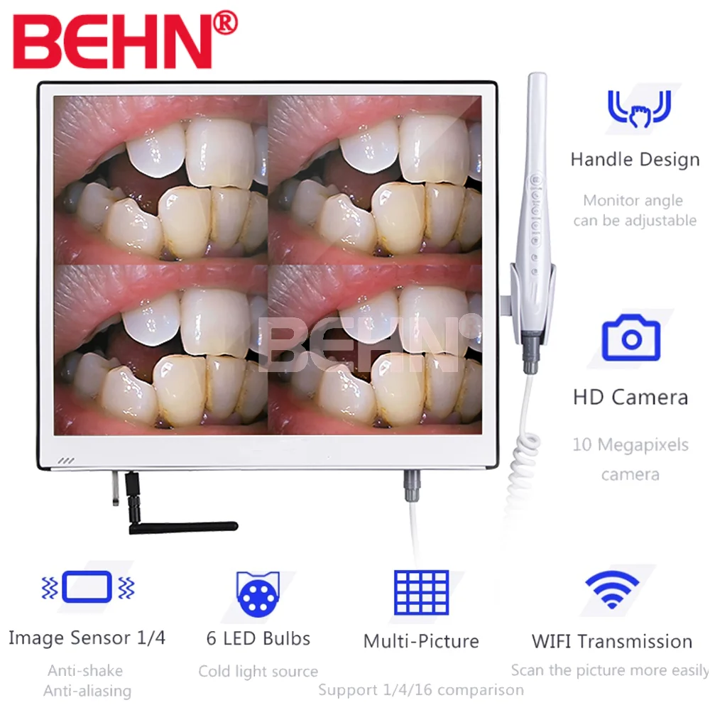 Камера-Эндоскоп для стоматологии, Wi-Fi, 10 миллионов пикселей