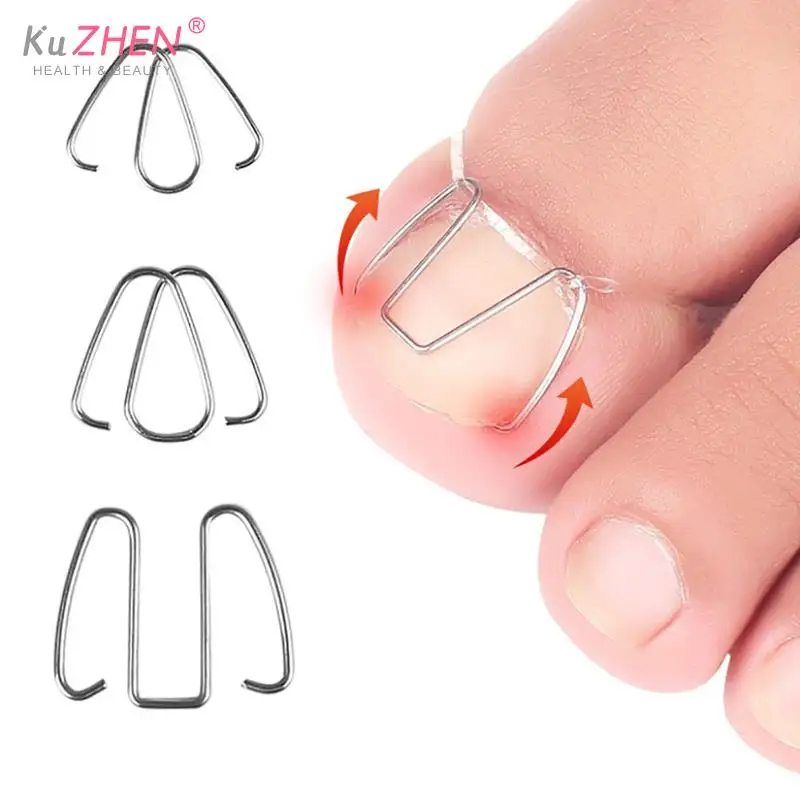 

3Pairs Front Nail Hook Nail Art Ingrown Toe Nail Correction Toenail Nail Ingrown Clip Orthosis Paronychia Pedicure Foot Care