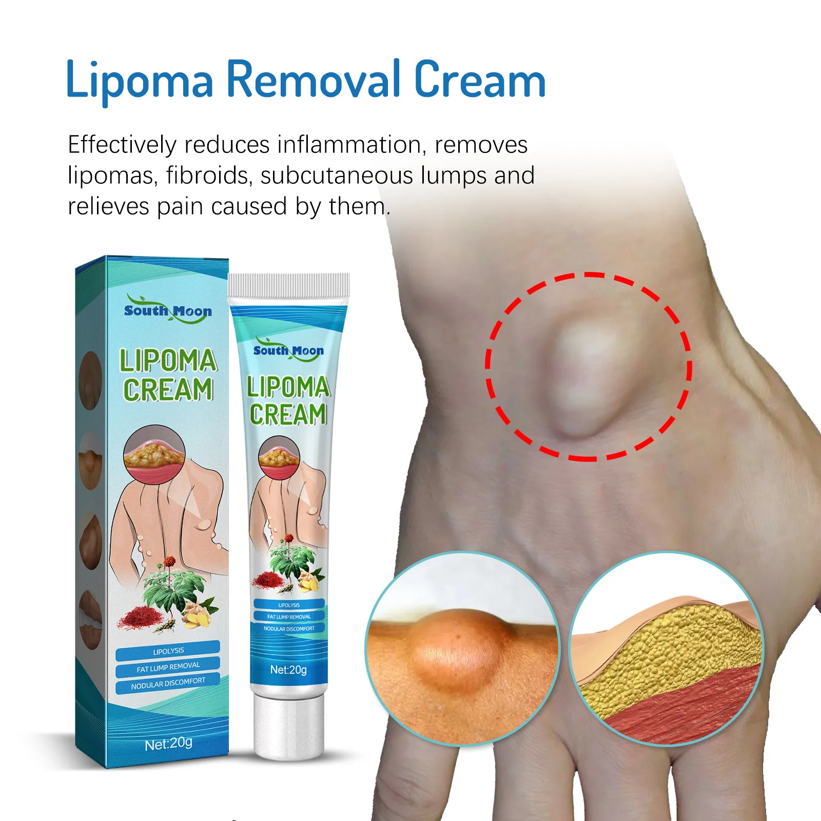 

20g Lipoma Removal Cream Relief Pain Treat Skin Swelling Lipolysis Cellulite Fat Lump Nodule Removal Ointment Anti-tumor Plaster