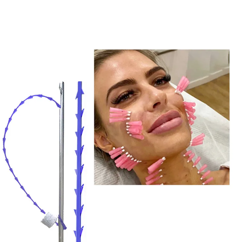 

PDO Thread Mono Screw Tornado Screw Face Lifting Lift Korea PDO L Blunt COG 3D 4D 6D Fish Bone Thread Molding Cog Fish Bone