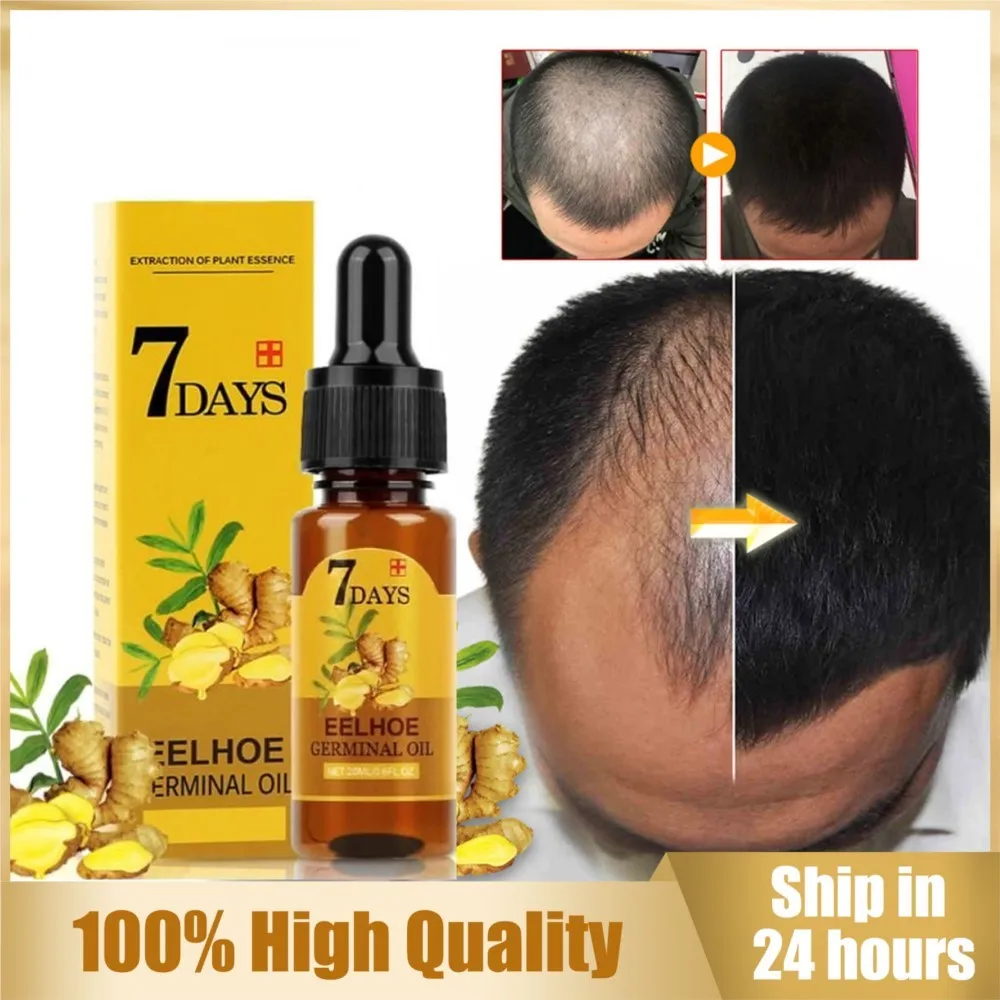 

Ginger Hair Growth Oil Natural Essentail Anti-Hair Loss Treatment Hair Hydrating Growth Nutrient Solution Care Massage Products