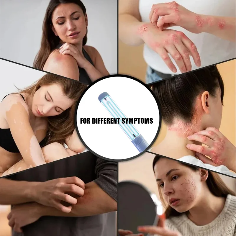 308 нм узкополосный ультрафиолетовый УФ-фототерапевтический инструмент УФ-лампа