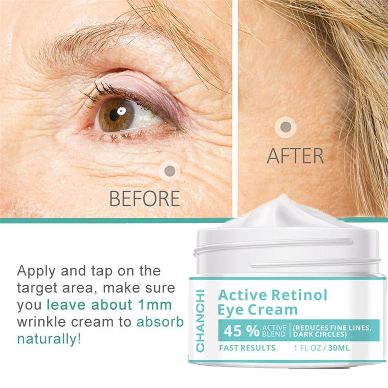 Мгновенное удаление мешков под глазами крем с ретинолом гель против отечности