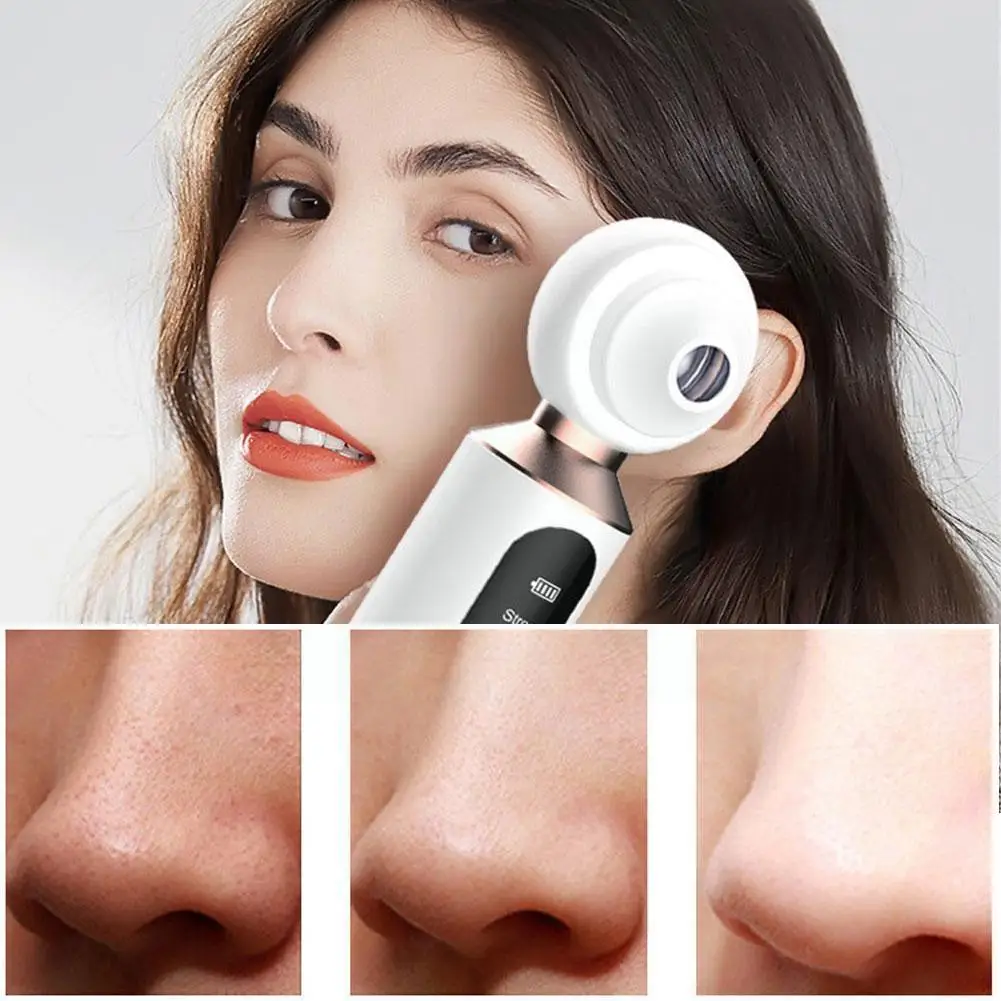 

Blackhead Rejuvenation Beauty Instrument Nose Pore Cleaner Home Blackhead Electric Instrument Beauty Instrument Portable Be Z4p2