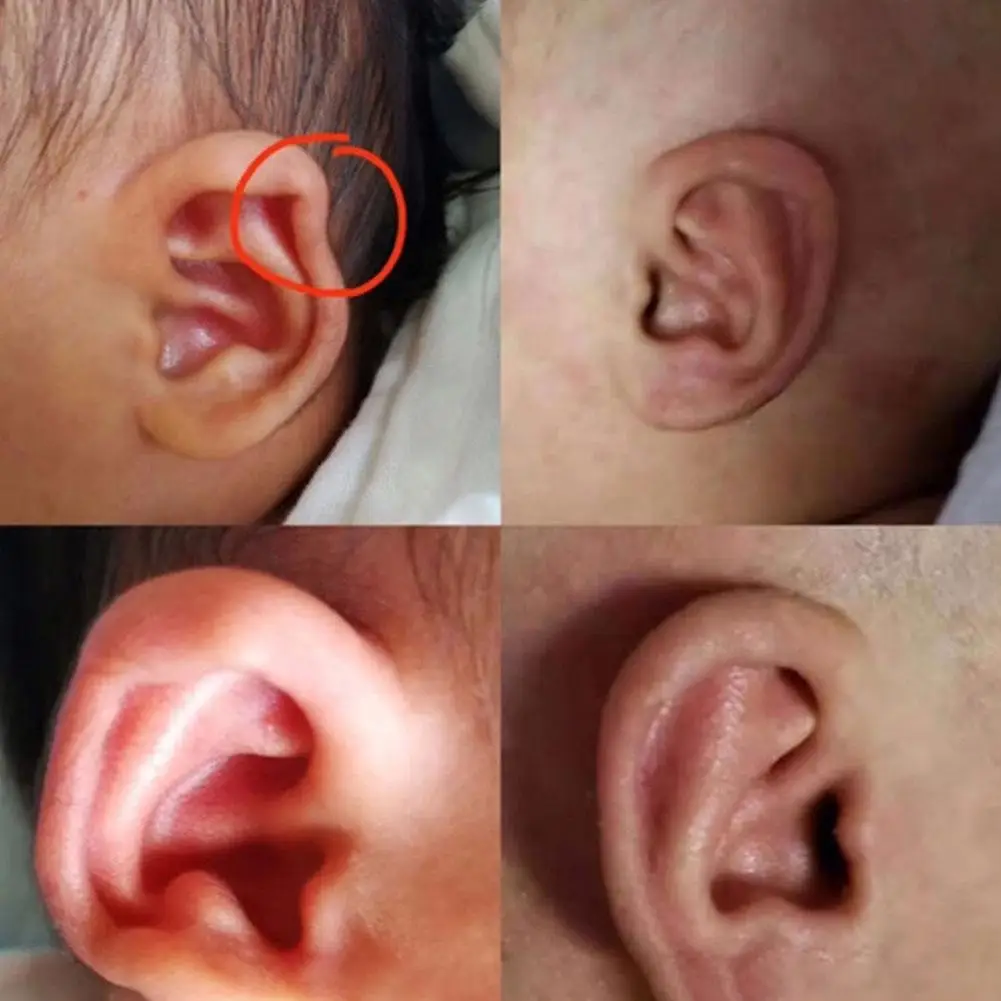 Рисунок 4 - Силиконовый пластырь для шрамов