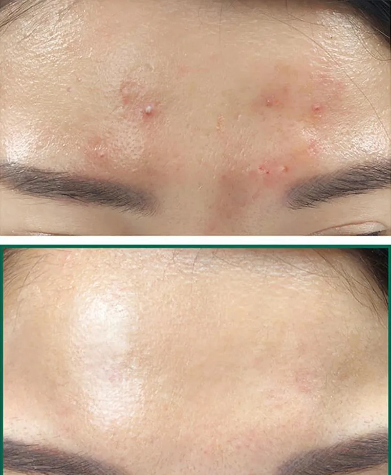 Отшелушивающий крем для лица SOME BY MI AHA BHA PHA 30 дней Miracle Cream + Essence уход за лицом