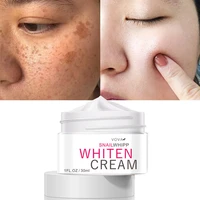 freckle whitening cream remove melasma acne dark spots fade pigment melanin anti aging moisturizing brighten skin care products