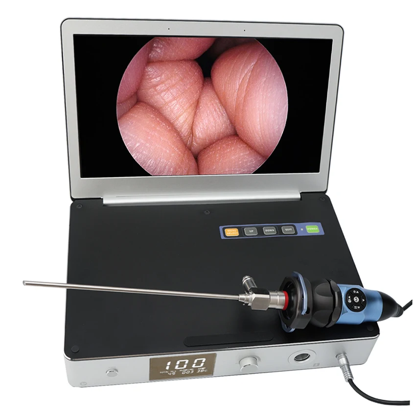 Интегрированная эндоскопическая камера USB HDMI Full HD Эндоскопическая Камера 11 6