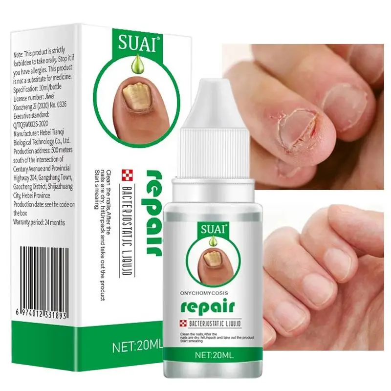 

Nail Repair Essence Nail Care Toenail Care Liquid For Toenail Or Fingernail Fix & Renew Damage Nail Repairs Protects Toenail
