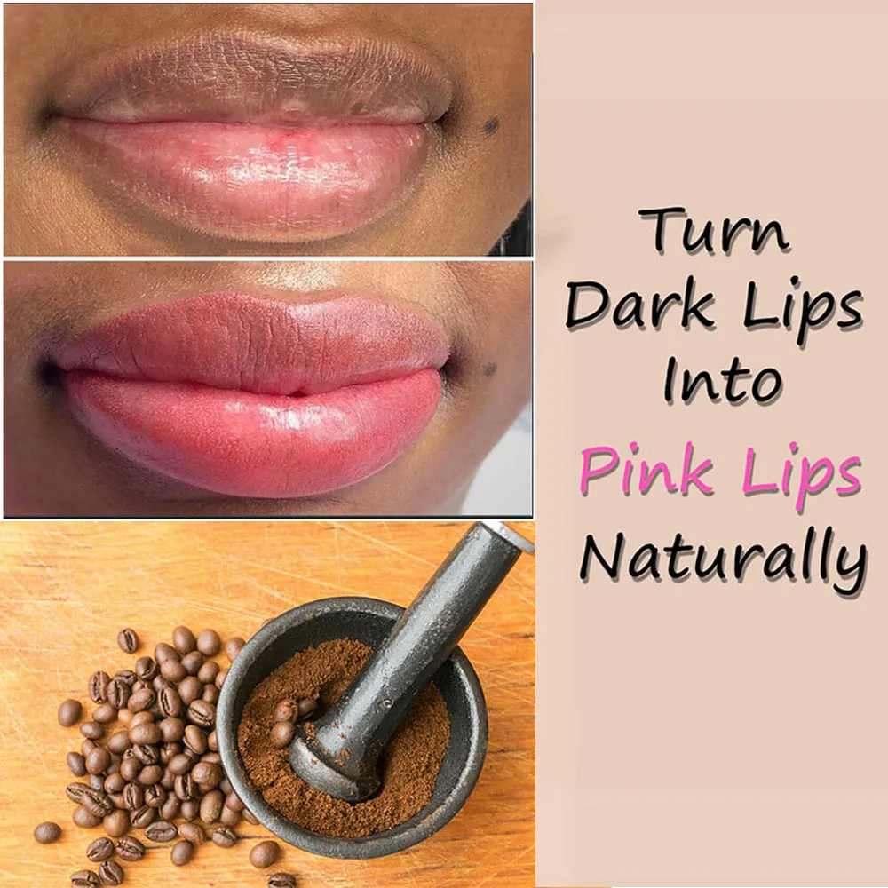 

South Africa Magic Lip Scrub Lighten Pigmented Lips Get Rid of Dark Lips Black Lips Turn Pink Get Pink Lips Permanently