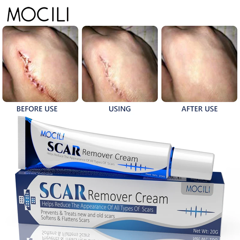 

Scar Removal Cream Repair Surgery Burn Stretch Marks Acne Soothing Moisturizing Even Skin Tone Smoothing Beauty Skin Care 20G