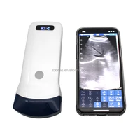 support ios android handheld ultrasound device handheld ultrasound price wireless ultrasound